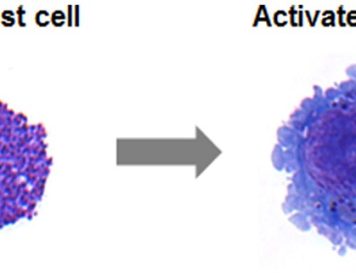 What is Mast Cell Activation Syndrome (MCAS)?