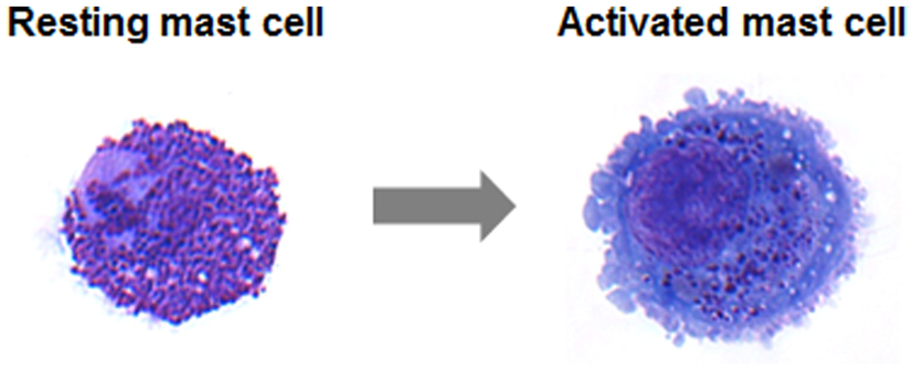 What is Mast Cell Activation Syndrome (MCAS)?